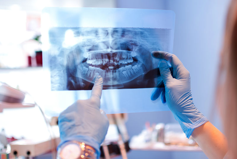 dental xray